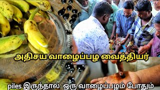 🔴piles தீர்வுக்கு வாழைப்பழத்தில் மருந்து  அதிசய வைத்திய முறை  yummyvlogs [upl. by Ilyse]