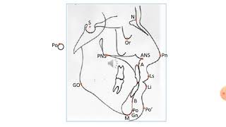 cephalometric analysis [upl. by Nyrrat]