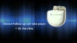 What is an Implantable Cardioverter Defibrillator ICD [upl. by Eisdnyl122]