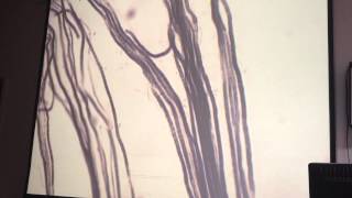 Myelinated nerve fibers [upl. by Devy]