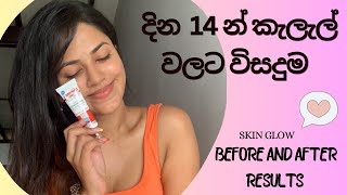 කැලැල් නැතිකරන Lighting glowing cream  Before and after results  Eventone C crem  100 recommend [upl. by Notsuj]