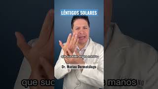 LÉNTIGOS SOLARES QUÉ SON Y CÓMO TRATARLOS [upl. by Whitcomb888]