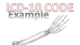 How to Code Correctly with ICD10 [upl. by Pylle]