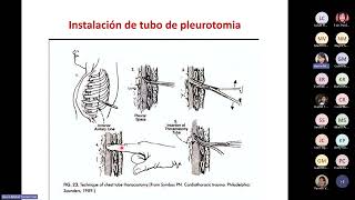 CLASE 3MÓDULO 4 Trauma Torácico  Reanimación de Control de Daños [upl. by Enela55]