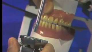 Delivery of Complete Denture  Part 2 [upl. by Eelyab]