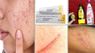 जले कटे या चोट के निशान गायब होंगे चुटकियो में  Scars Removal Remedy [upl. by Wailoo]