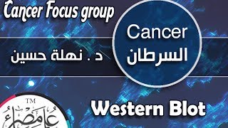 ُ ESCancer Focus Group  Western Blot [upl. by Aneeres]