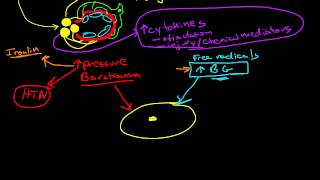 Pathophysiology of Diabetic Nephropathy [upl. by Gibbon]