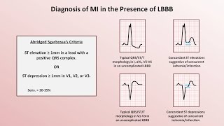 Intro to EKG Interpretation  Myocardial Infarctions Part 2 of 2 [upl. by Roede824]