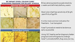 stool colour chart [upl. by Olegnad]