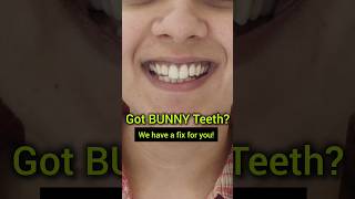 Got BUNNY Teeth Watch this video now Dr Srishti Bhatia smile smilemakeover braces [upl. by Fine]