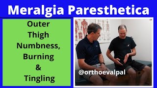 Meralgia Paresthetica Outer thigh numbness burning and tingling [upl. by Stag]