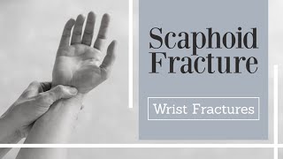 Scaphoid Fractures  carpal bone fracture [upl. by Isherwood148]