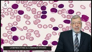 Episode 4 Lymphocytes amp Lymphocytosis [upl. by Lavona]