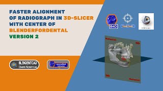 Faster 3D Slicer Segmentation alignment with Blenderfordental Center  Version 2 [upl. by Corley]