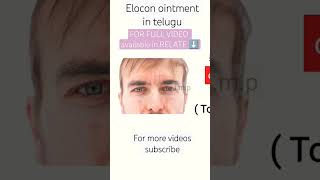 elocon ointment review in telugu  full video in relate button medicine fact [upl. by Etheline]