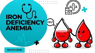 Iron deficiency anemiairon deficiency anemia treatmentanemia notesiron deficiency anemia symptoms [upl. by Leahcimrej]