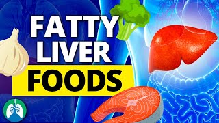 Top 10 Foods to Combat a Fatty Liver Naturally ⚠️ [upl. by Portwin912]