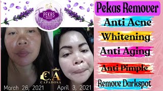 PEKAS ERASER CREAM  Pekas Remover  Capadosa Beauty Products  Safe amp Effective  Maria Nilda [upl. by Kerianne651]