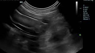 Small Animal Ultrasound  Foreign Body obstructing the Small intestine [upl. by Etnahc]