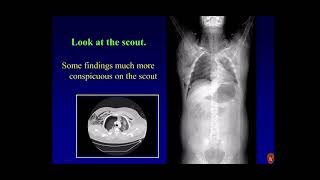 Imaging thoracoabdominal and spinal trauma [upl. by Neelyad]