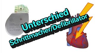 Was ist der Unterschied zwischen einem Defibrillator und einem Schrittmacher [upl. by Newsom314]