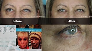 Instantly Ageless COMPLETE Review  Demo [upl. by Savick]