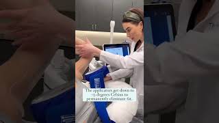 CoolSculpting Elite at The Skin Center [upl. by Yannodrahc200]