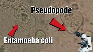 Entamoeba coli under the microscope pseudopods شاهد الأميبة تحت المجهر [upl. by Epolulot]