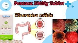 Pentasa 500Mg Tablet UseBenefitsSide EffectsUlcerative Colitis TreatmentFull Reviews [upl. by Midas]