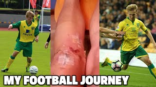 Becoming A Professional Footballer  ACL Surgery Being Released amp Academy Truth My Pro Journey [upl. by Mit]