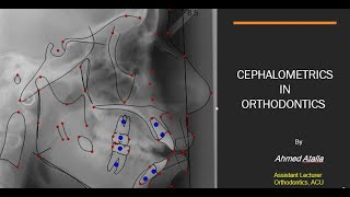 Cephalometrics in orthodontics By Dr Ahmed Atalla [upl. by Campman801]