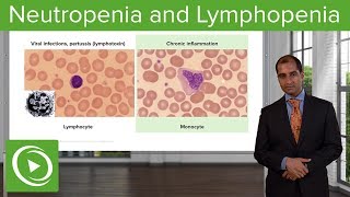 Quantitative WBC Disorders Leukocytosis amp Leukopenia – Pathology  Lecturio [upl. by Frederich]