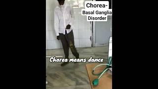 Chorea Movement Disorder mbbs neetpg next [upl. by Erbua]