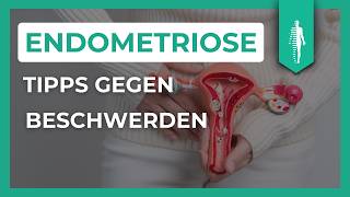 Pille Schmerzmittel amp Alternativen Die besten Tipps für Endometriose und Adenomyose [upl. by Rovit]