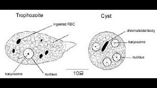 Trophozoite and Cyst of Entamoeba histolytica in LPCB mount [upl. by Ahsaten841]