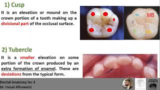 Dental Anatomy lec 3 Anatomical Landmarks with MCQs [upl. by Bartolemo35]