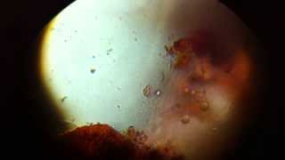 Blastocystis hominis IMG 3816 [upl. by Cirda]