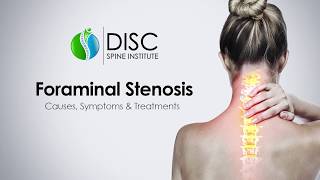 Pinched Nerve in Neck or Back Foraminal Stenosis Causes Symptoms Treatments [upl. by Rahal347]