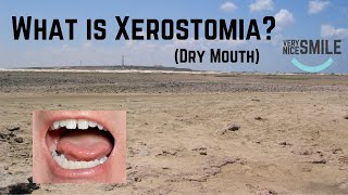 What is Xerostomia [upl. by Ttik]