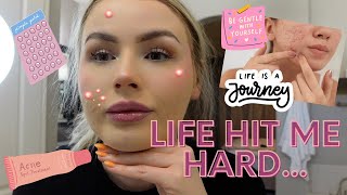 BEST and WORST acne products and makeup [upl. by Jeramey659]