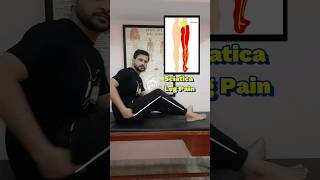 Sciatica Leg Pain Relief Exercise [upl. by Faustina474]