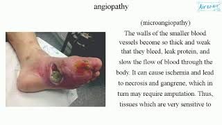 angiopathy English  Medical terminology for medical students [upl. by Tybie]