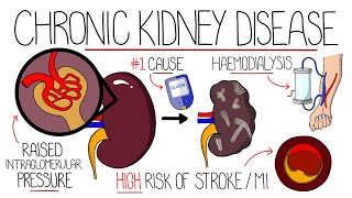 Understanding Chronic Kidney Disease CKD [upl. by Dripps]