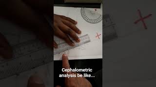 Cephalometric analysis detectivework orthodontics smile subscribe credits comment antropology [upl. by Phil]