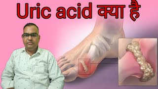 uric acid kya hai । क्यों होता है । iske side effect kya dekhne ko milte Hain [upl. by Ynitsed]