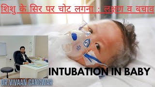 Gasping Condition In Baby  Paediatric Intubation  Intubation Procedure In Newborn  Intubation [upl. by Aiden465]