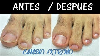 CÓMO HACER UN PEDICURE PASO A PASO MUY FÁCIL  Como hacer un Pedicure paso a paso [upl. by Chor]