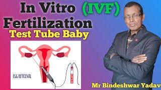 In Vitro Fertilization step by step Process  Test Tube Baby  IVF  Mr Bindeshwar Yadav [upl. by Tildie]