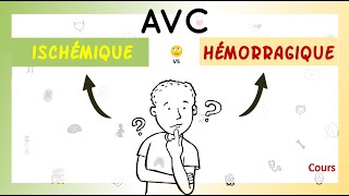 🤨AVC Hémorragique🥵 VS Ischémique🥶 Partie 22  Cours  Neurologie [upl. by Luis107]